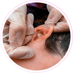 Aula prática de auriculoterapia - Curso de Massoterapia