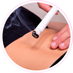 Aula prática de moxabustão - Curso de Massoterapia